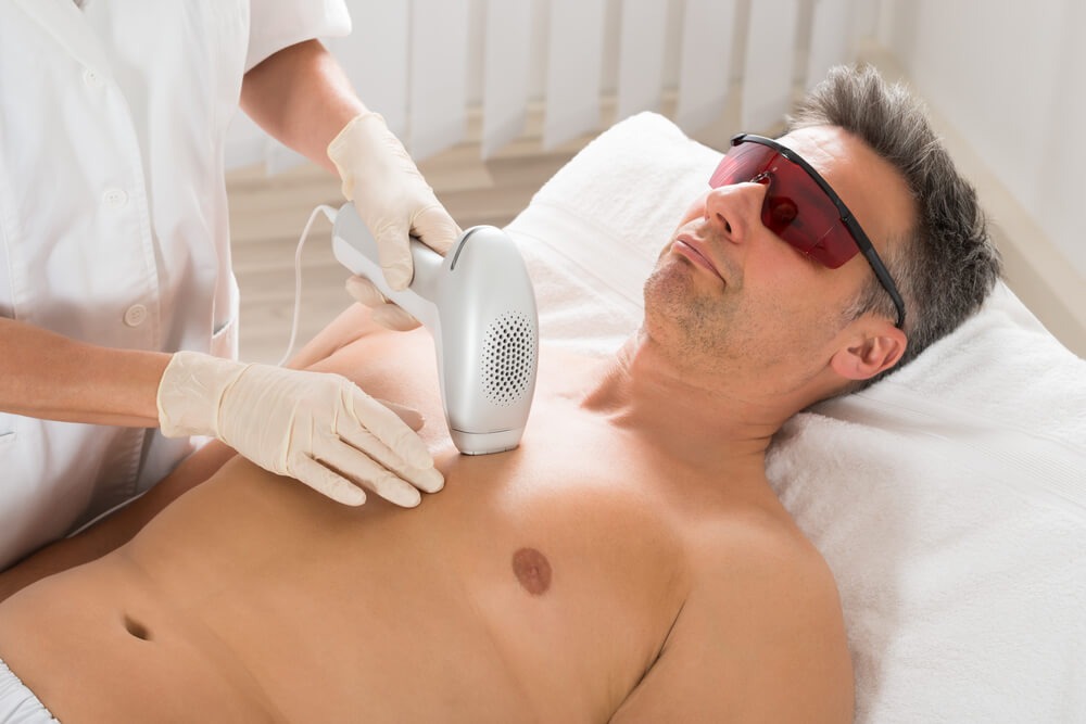 Tips For Your First Laser Hair Removal
